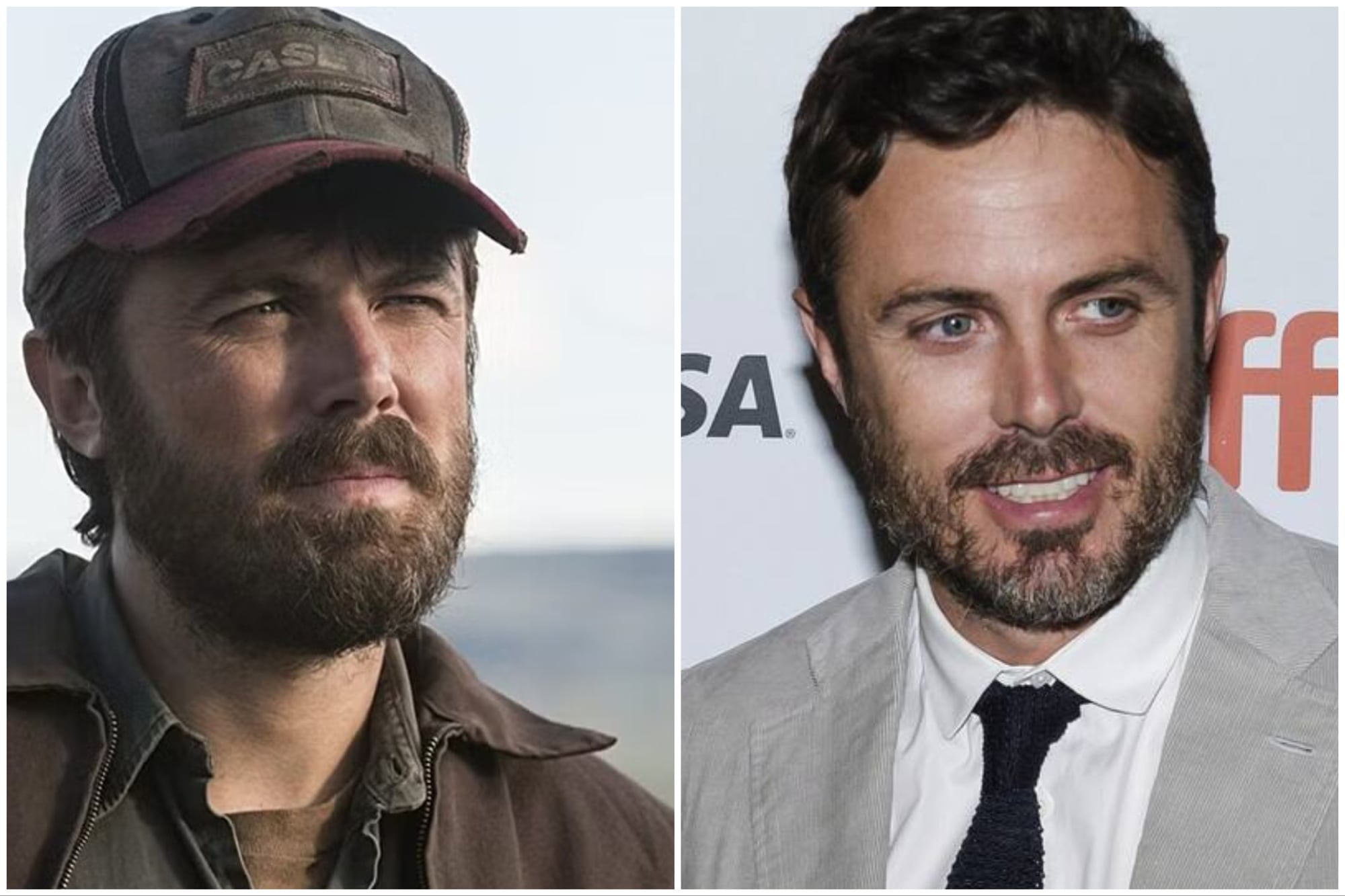 El antes y el después de Casey Affleck