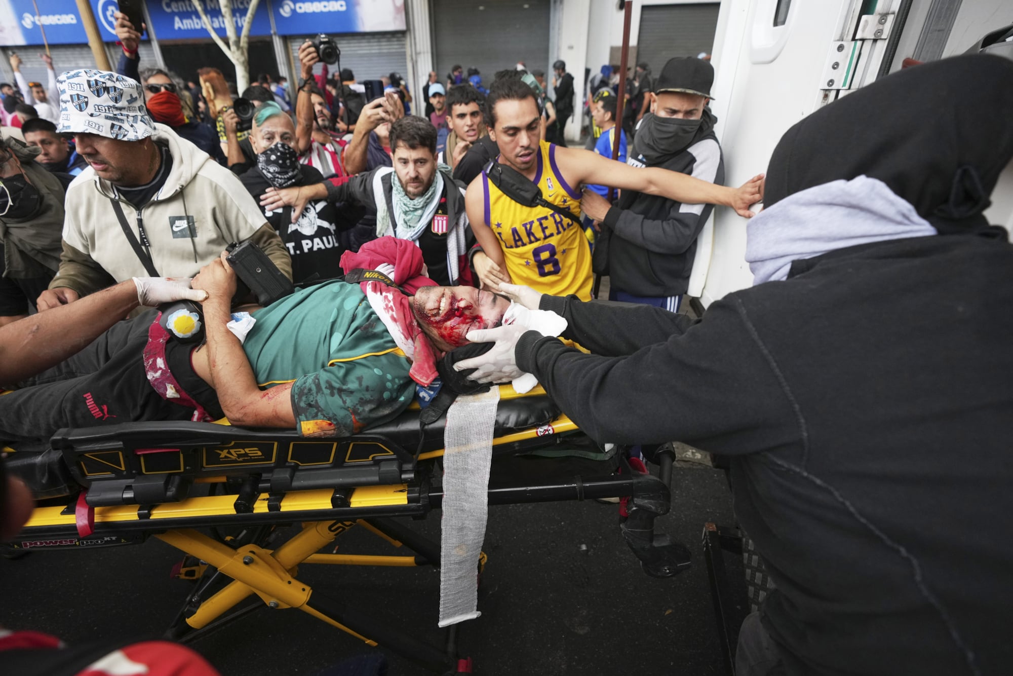 El fotógrafo Pablo Nahuel Grillo, al ser trasladado al hospital Ramos Mejía tras recibir un fuerte golpe en el cráneo