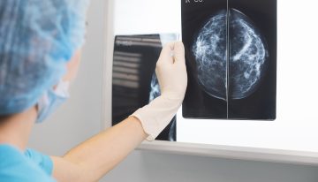 ¿Cuántos minutos de ejercicios por semana? Por qué los oncólogos necesitan guías precisas para incentivar a sus pacientes
