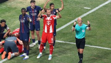 Así fue la tremenda lesión de Musiala, jugador de Bayern Munich, en el partido ante PSG por el Mundial de Clubes