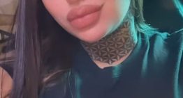 Tamara Báez mostró el antes y el después del doloroso retoque estético que se hizo