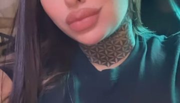 Tamara Báez mostró el antes y el después del doloroso retoque estético que se hizo