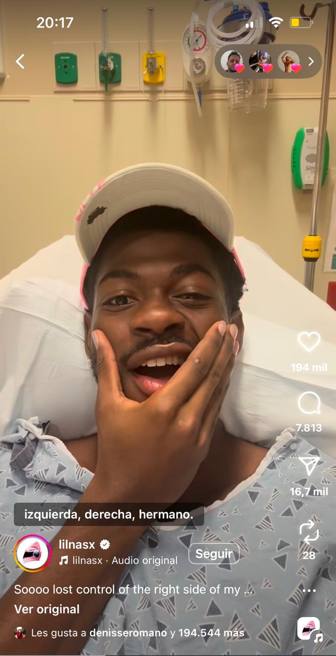 La parálisis facial que mostró en redes. (Fuente: Instagram/lilnasx)