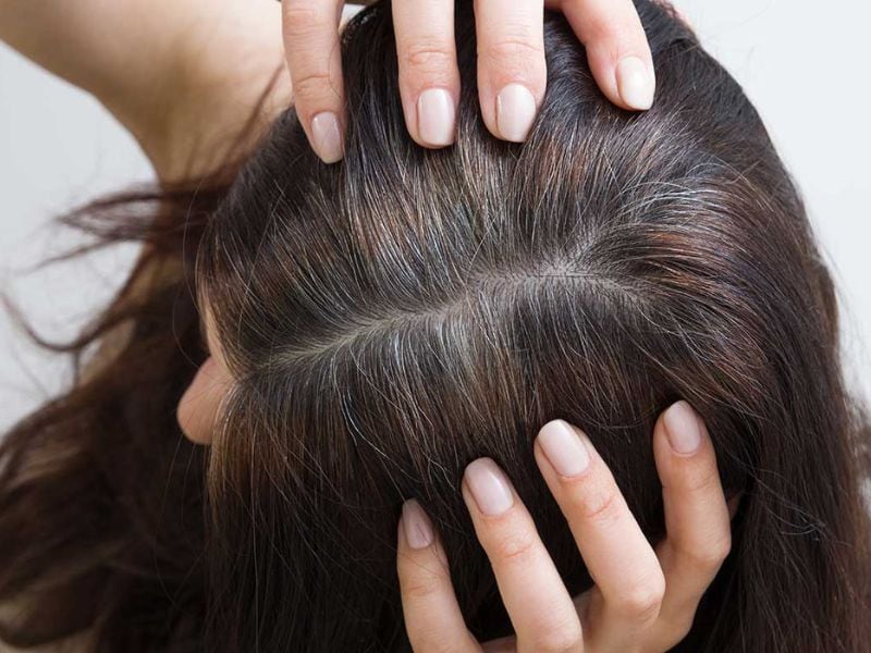 Arrancarse una cana puede irritar la piel del cuero cabelludo