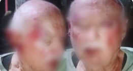 Brutal agresión a una pareja de jubilados en Mar del Plata: los atacaron mientras tomaban mates en la vereda