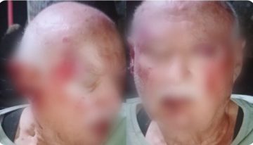 Brutal agresión a una pareja de jubilados en Mar del Plata: los atacaron mientras tomaban mates en la vereda