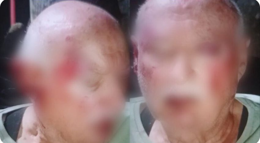 Brutal agresión a una pareja de jubilados en Mar del Plata: los atacaron mientras tomaban mates en la vereda