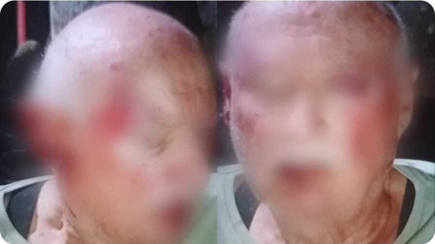 Brutal agresión a una pareja de jubilados: los atacaron mientras tomaban mates en la vereda (Foto: 0223)