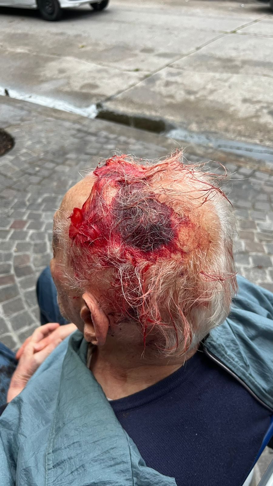 El hombre de 96 años sufrió un violento golpe en la cabeza (Foto: TN).
