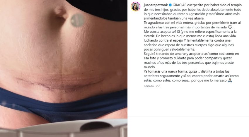 Juana Repetto mostró cómo le quedó la cicatriz de la cesárea y dejó una fuerte reflexión sobre su cuerpo