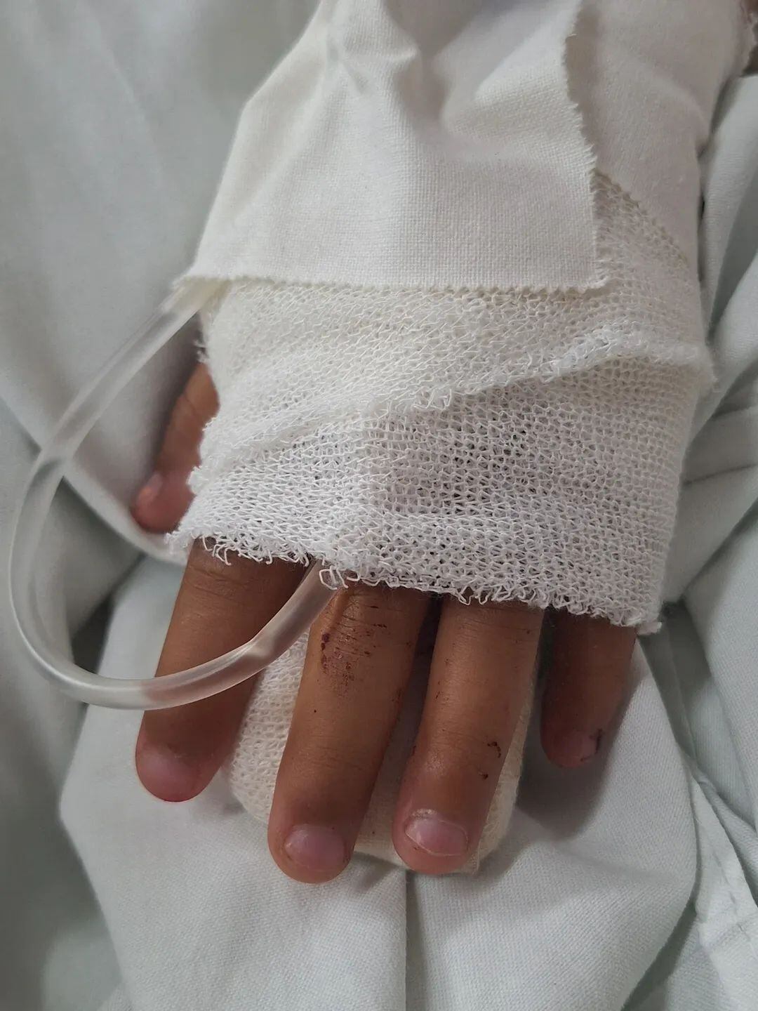 La nena se arrojó del auto en movimiento para escapar y sufrió lesiones. (Foto: TN).