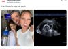 Juan Reverdito, exparticipante de “Gran Hermano”, anunció que va a ser papá: las tiernas fotos