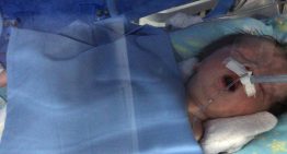 Le dieron un diagnóstico irreversible pero lucharon y su hijo logró avances extraordinarios: “No va a caminar, no va a hablar, no va a comer”