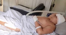 Qué es el síndrome de Gorham-Stout, la enfermedad rara que destruye los huesos y cambió la vida de Pedro