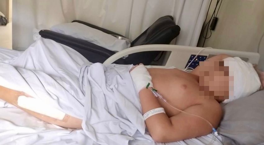 Qué es el síndrome de Gorham-Stout, la enfermedad rara que destruye los huesos y cambió la vida de Pedro