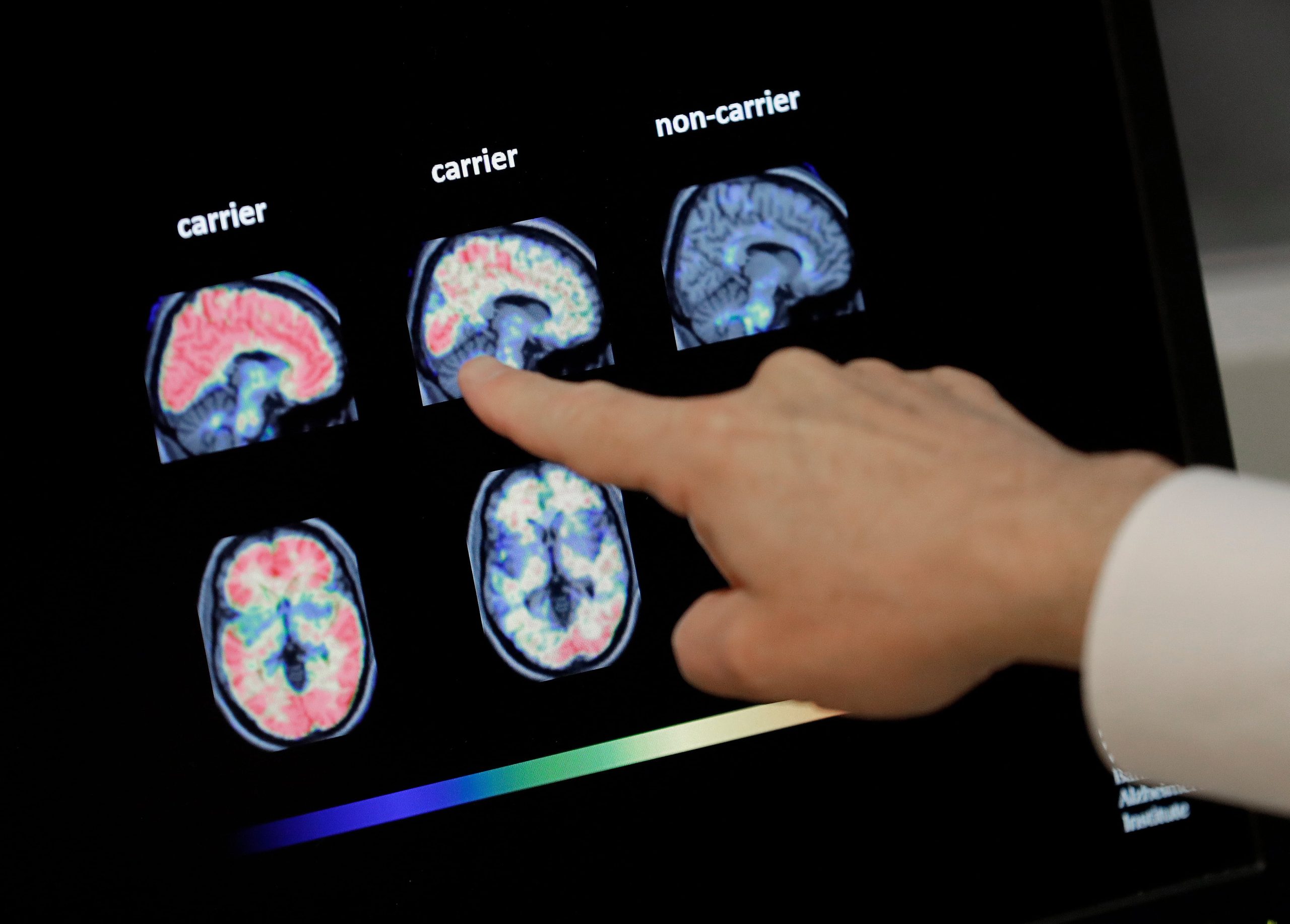Un médico revisa una tomografía del cerebro