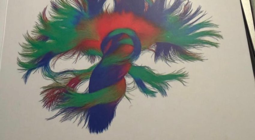 Neurociencias y memoria: un puente entre la ciencia y la compasión