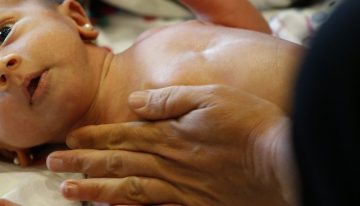 Pediatras llaman a la inmunización «urgente» de las guaguas contra el sincicial