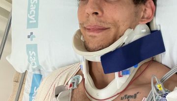 Actor de «La Casa de Papel» sufrió accidente en moto: Fue operado de urgencia