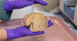 Estudio descifró secretos de los «superancianos», octogenarios con cerebros de 50 años