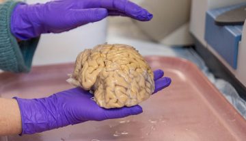 Estudio descifró secretos de los «superancianos», octogenarios con cerebros de 50 años