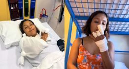 Chilena perdió dos dedos mientras trabajaba como instructora de buceo en Australia