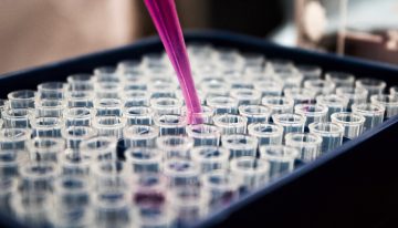 Colombia cuenta con nuevas pruebas para diagnosticar el covid-19; ¿serán más eficaces?
