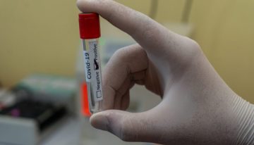 Siguen cayendo los casos activos, aunque el número de contagios superó los 800.000