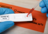 ¿Dejaremos de estar protegidos frente al coronavirus cuando disminuyan nuestros anticuerpos?