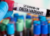 ¿Somos más contagiosos con la variante Delta aunque estemos vacunados?
