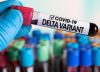 Variante Delta es predominante en Colombia: Emergencia sanitaria se extenderá hasta el 28 de febrero de 2022