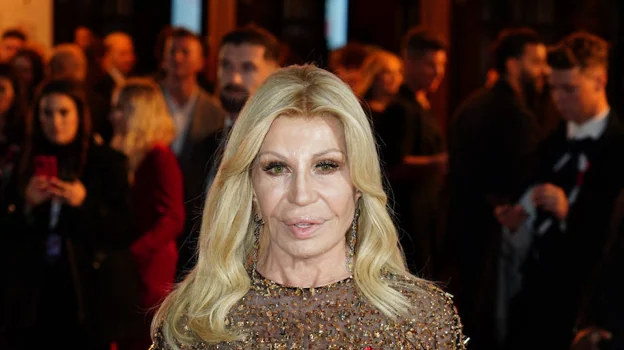 El sorprendente cambio físico de Donatella Versace analizado por doctores expertos en cirugía y medicina estética