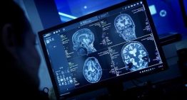 ¿Qué ocurre en tu cerebro cuando tu mente se queda en blanco?