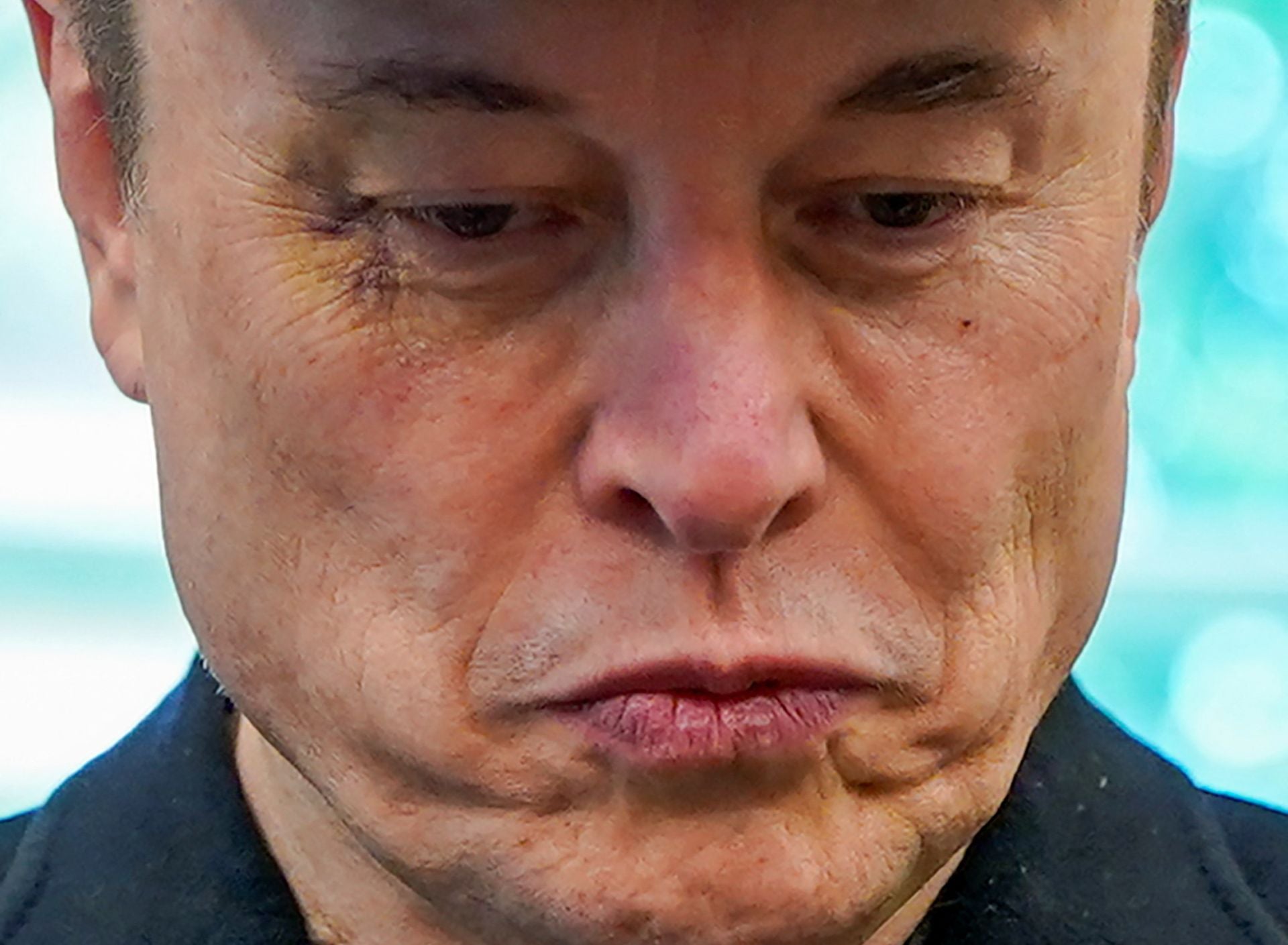 Elon Musk, con un ojo visiblemente dañado.