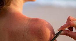 Revolucionario hallazgo en cáncer de piel: un estudio descubre el potencial de un virus común frente al melanoma