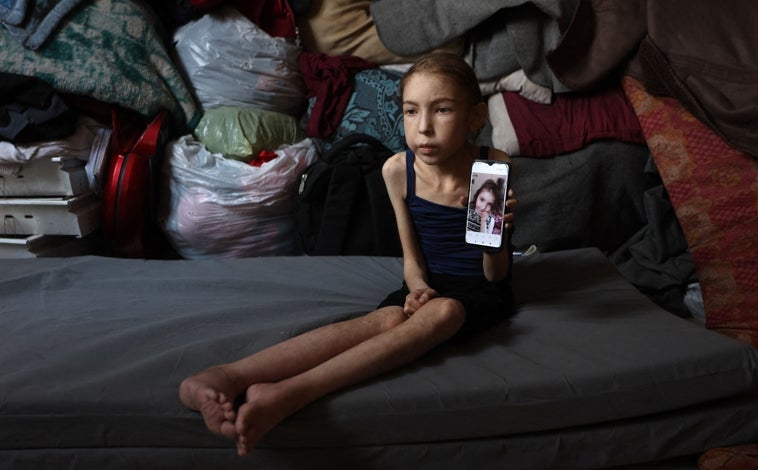 Imagen principal - Rafah Ayyad, una palestina de 12 años en Gaza, muestra evidentes signos de desnutrición