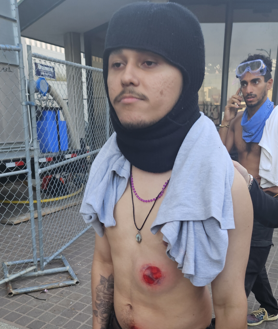 Imagen secundaria 2 - Los manifestantes portan banderas de México, en la primera imagen. En la segunda foto: jóvenes queman rueda con sus minimotos. En la tercera imagen se aprecia un joven manifestante con heridas producidas por las pelotas de goma que han utilizado las Fuerzas de seguridad.
