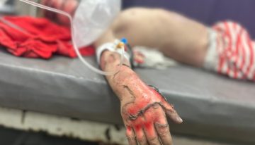 El anestesista español que salva vidas en la 'casa de los horrores' de Gaza: «La mayoría son niños, mujeres y jóvenes»