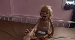 Aumentan a más de 315 los muertos por hambre en Gaza por la ofensiva de Israel, incluidos más de 120 niños