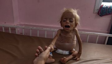 Aumentan a más de 315 los muertos por hambre en Gaza por la ofensiva de Israel, incluidos más de 120 niños