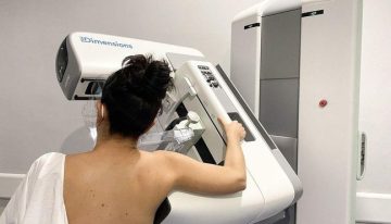 Catalunya no registra fallos en los cribados de mamografías como los de Andalucía