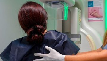 Los radiólogos defienden su trabajo en la crisis de los cribados «en entornos de alta presión asistencial y con recursos limitados»