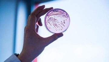 Superbacterias: así es la nueva amenaza mundial que causará más muertes que el cáncer en 2050