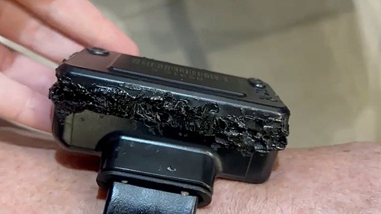 Bolsonaro asegura que manipuló la tobillera por «alucinaciones»  por los medicamentos psiquiátricos