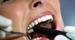 Microbiota de la boca y cáncer de páncreas: una investigación prometedora