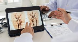 La Síndica de Greuges investiga la falta de atención 24 horas para el ictus en Lleida y Tarragona