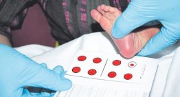 Angioedema hereditario: así es la enfermedad minoritaria transmitida por un donante de semen en Catalunya