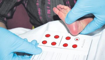 Angioedema hereditario: así es la enfermedad minoritaria transmitida por un donante de semen en Catalunya