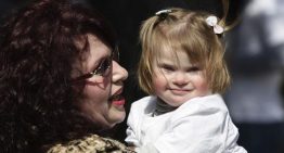 Casi la mitad de los bebés con síndrome de Down nacen con una cardiopatía congénita: «La clave es operarles pronto»