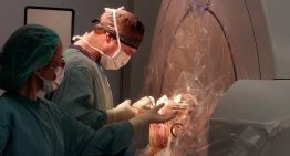 La estimulación cerebral profunda salva a un joven con síndrome de Tourette: «Tenía un alto riesgo de suicidio y vivía aislado; ahora estudia y va al cine»